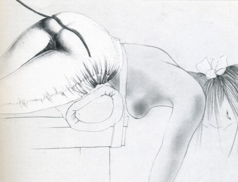 Hans Braun